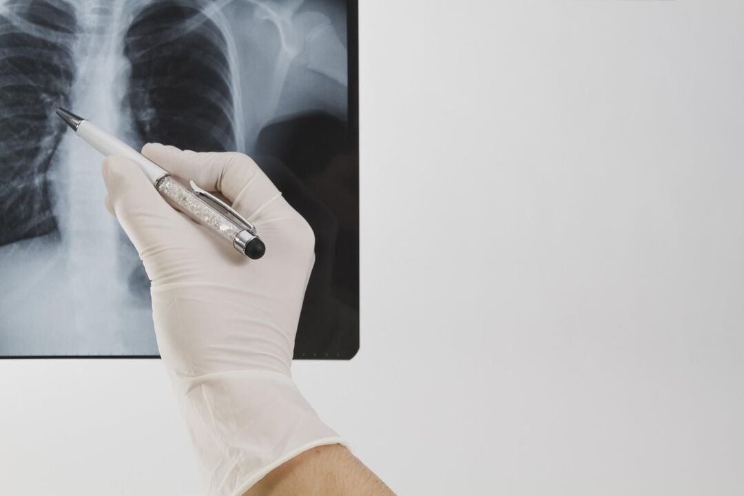 X-ray don gano osteochondrosis