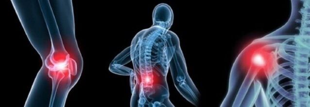Nau'in jin zafi tare da Arthrosis