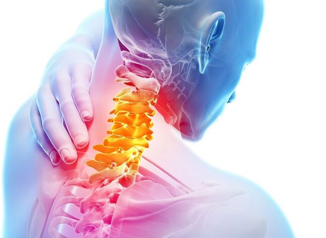 Bayyanar cututtuka da matakai na cigaban osteochondrosis